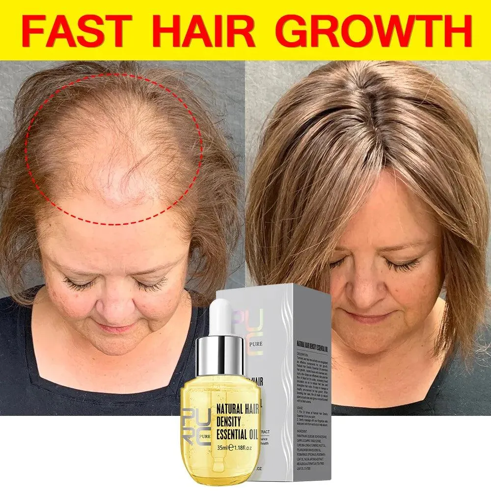 Ginger Hair Growth Serum for Stronger, Healthier Hair