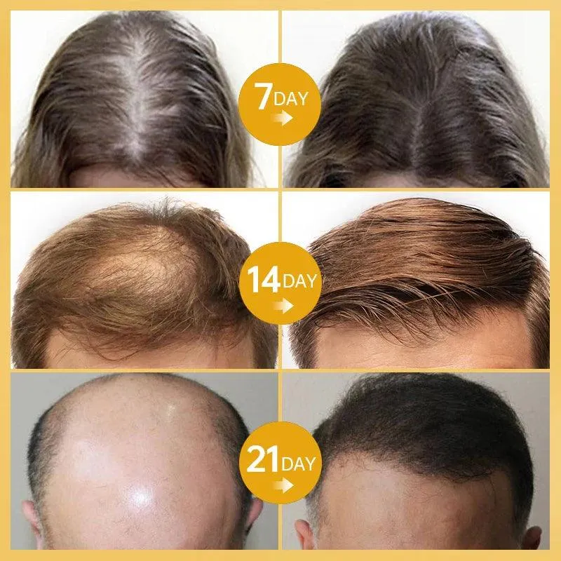 Ginger Hair Growth Serum for Stronger, Healthier Hair