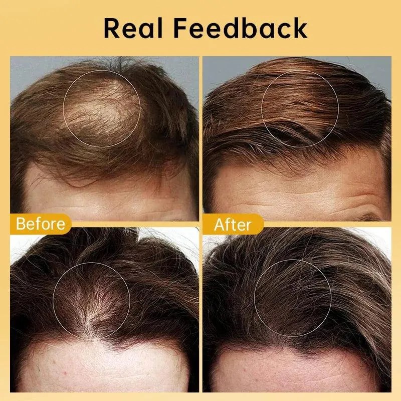 Ginger Hair Growth Serum for Stronger, Healthier Hair