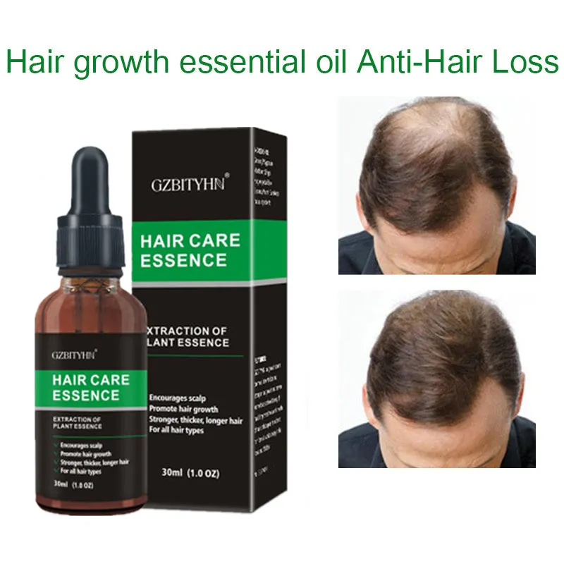 Hair Growth Oil – Essential Scalp Care for Stronger, Healthier Hair
