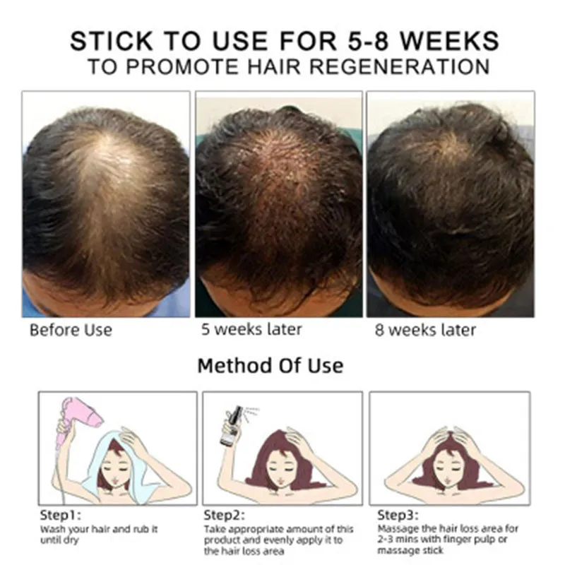 Hair Growth Oil – Essential Scalp Care for Stronger, Healthier Hair