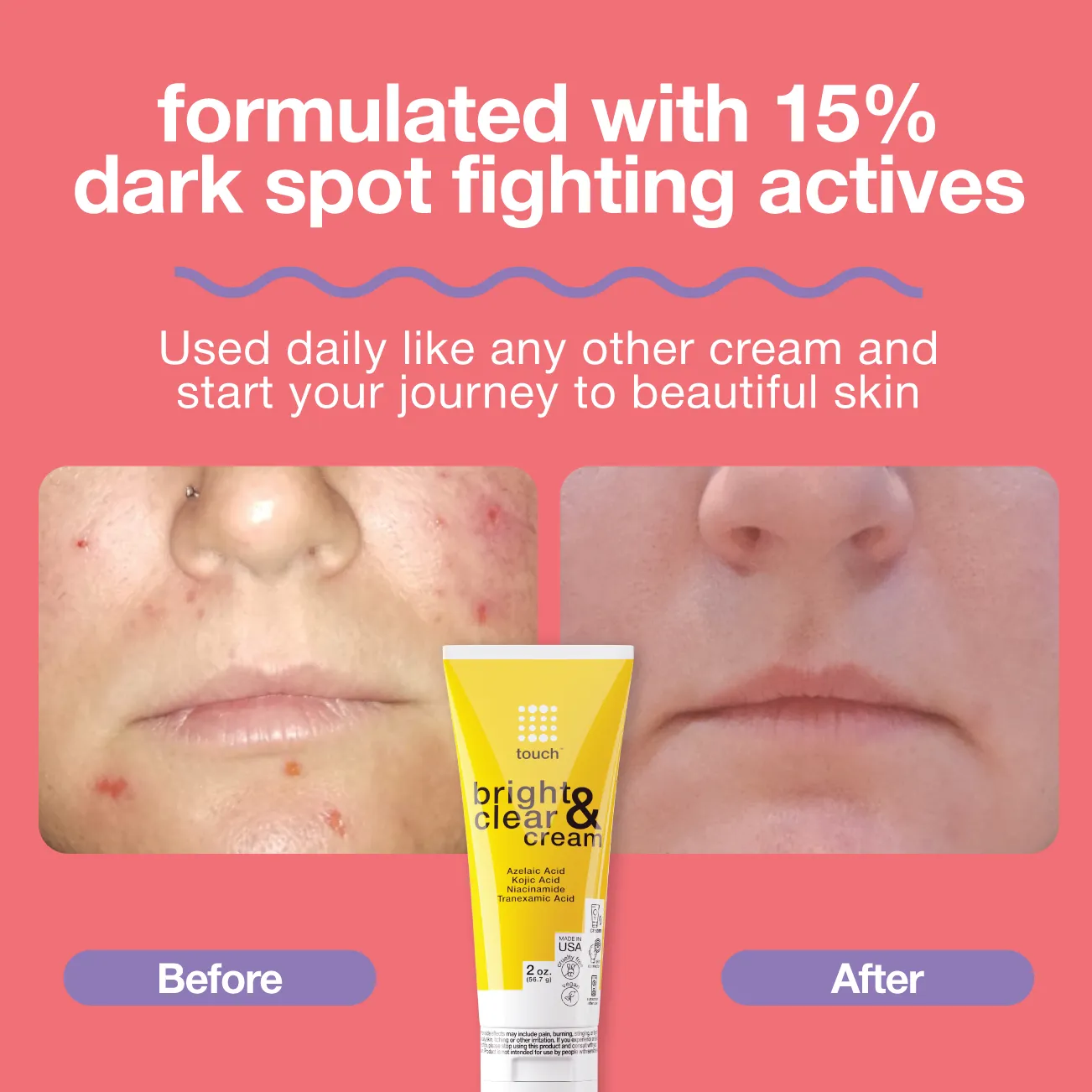 Innovative Skin Lightening Cream for Face and Body